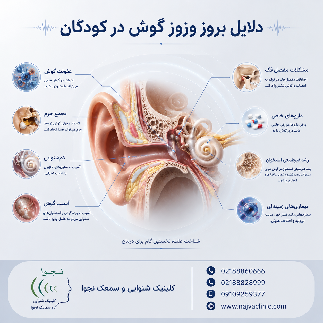 تصویر پزشکی دلایل بروز وزوز گوش در کودکان